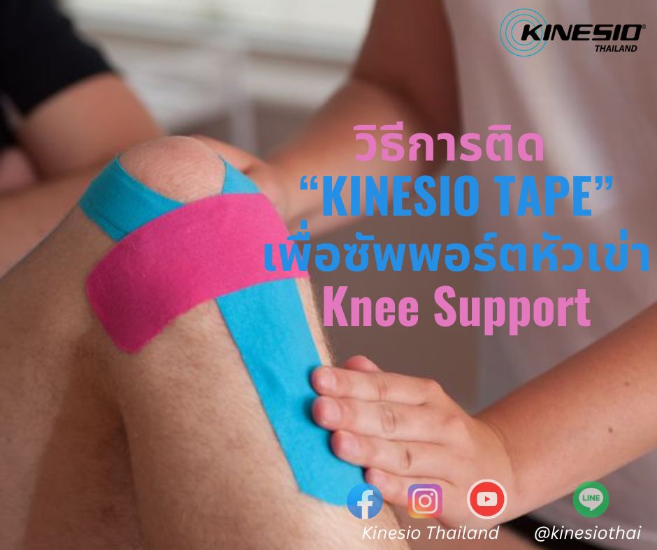 การติด Kinesio Tape เพื่อซัพพอร์ตหัวเข่า Knee support
